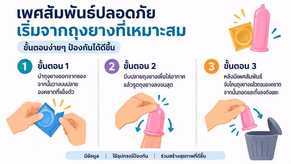 คู่มือภาพสามขั้นตอนสำหรับการใช้ถุงยางอนามัยภายนอก ตั้งแต่เปิดซองจนถึงถอดและทิ้งหลังเพศสัมพันธ์